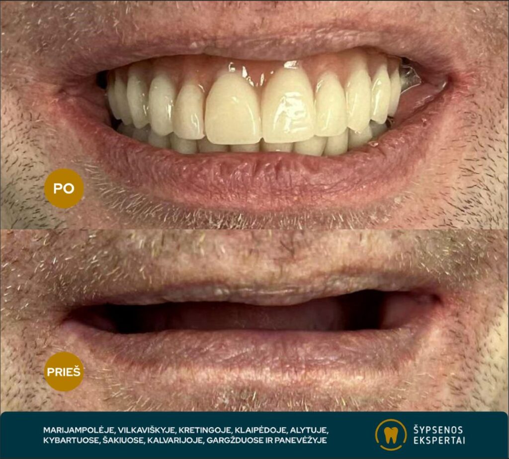 all on 4_atliktu darbu galerija