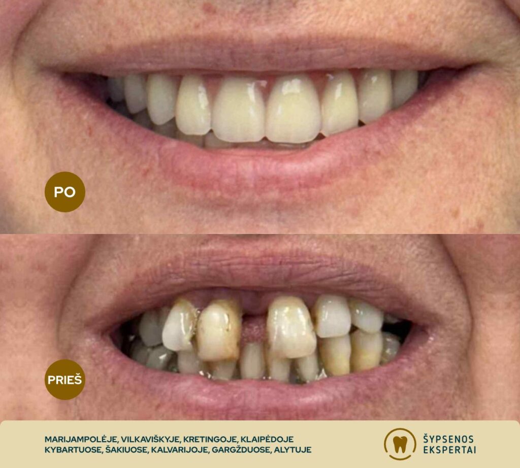 all on 4_atliktu darbu galerija