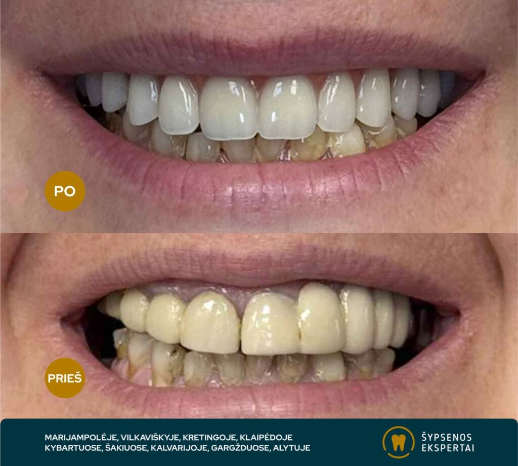 all on 4_atliktu darbu galerija