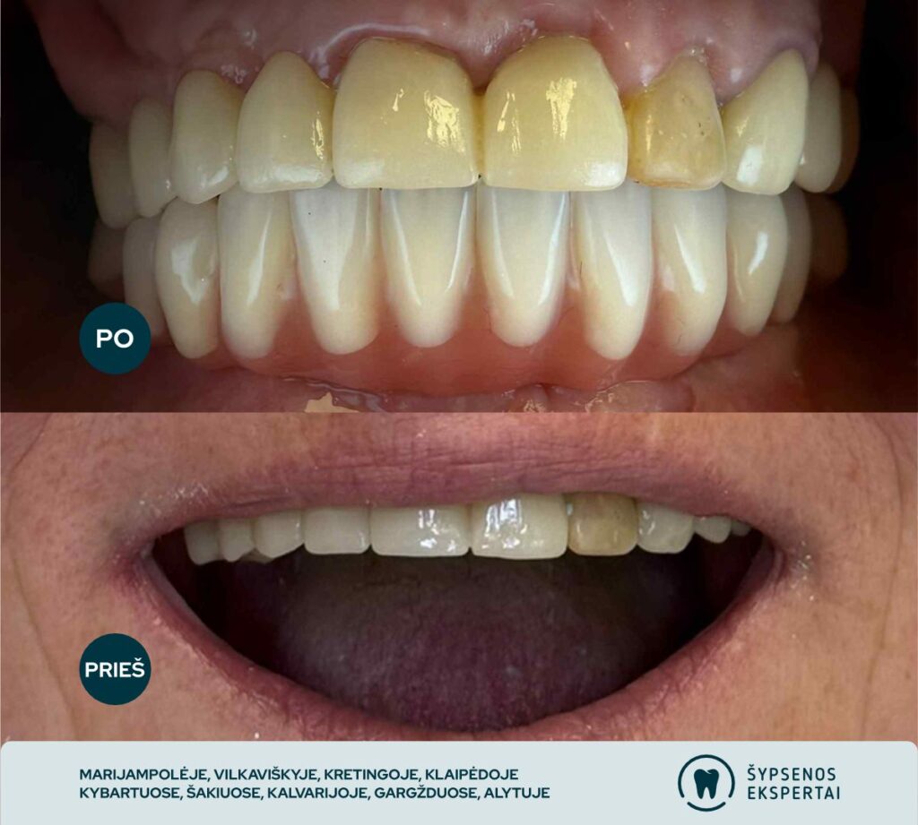 all on 4_atliktu darbu galerija