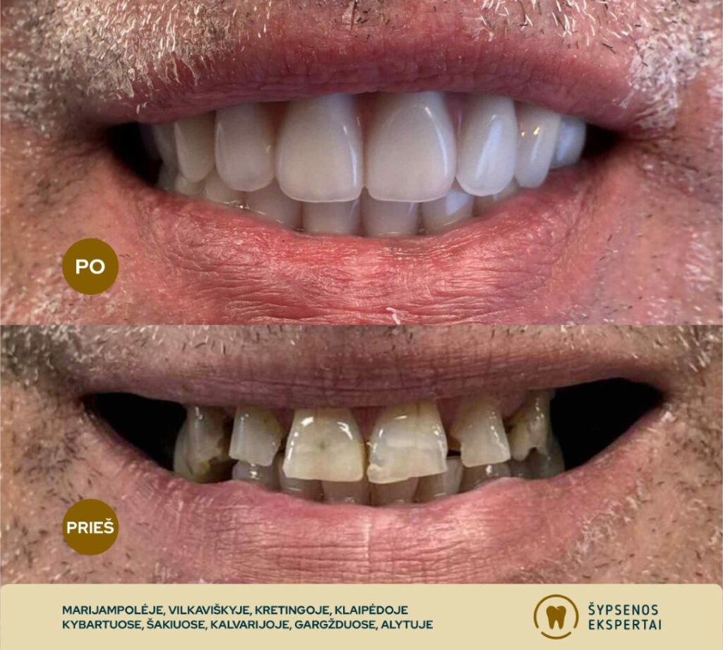 all on 4_atliktu darbu galerija