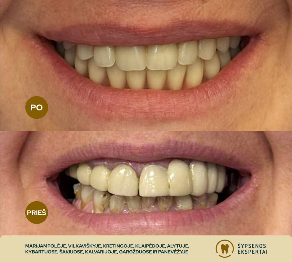 all on 4_atliktu darbu galerija