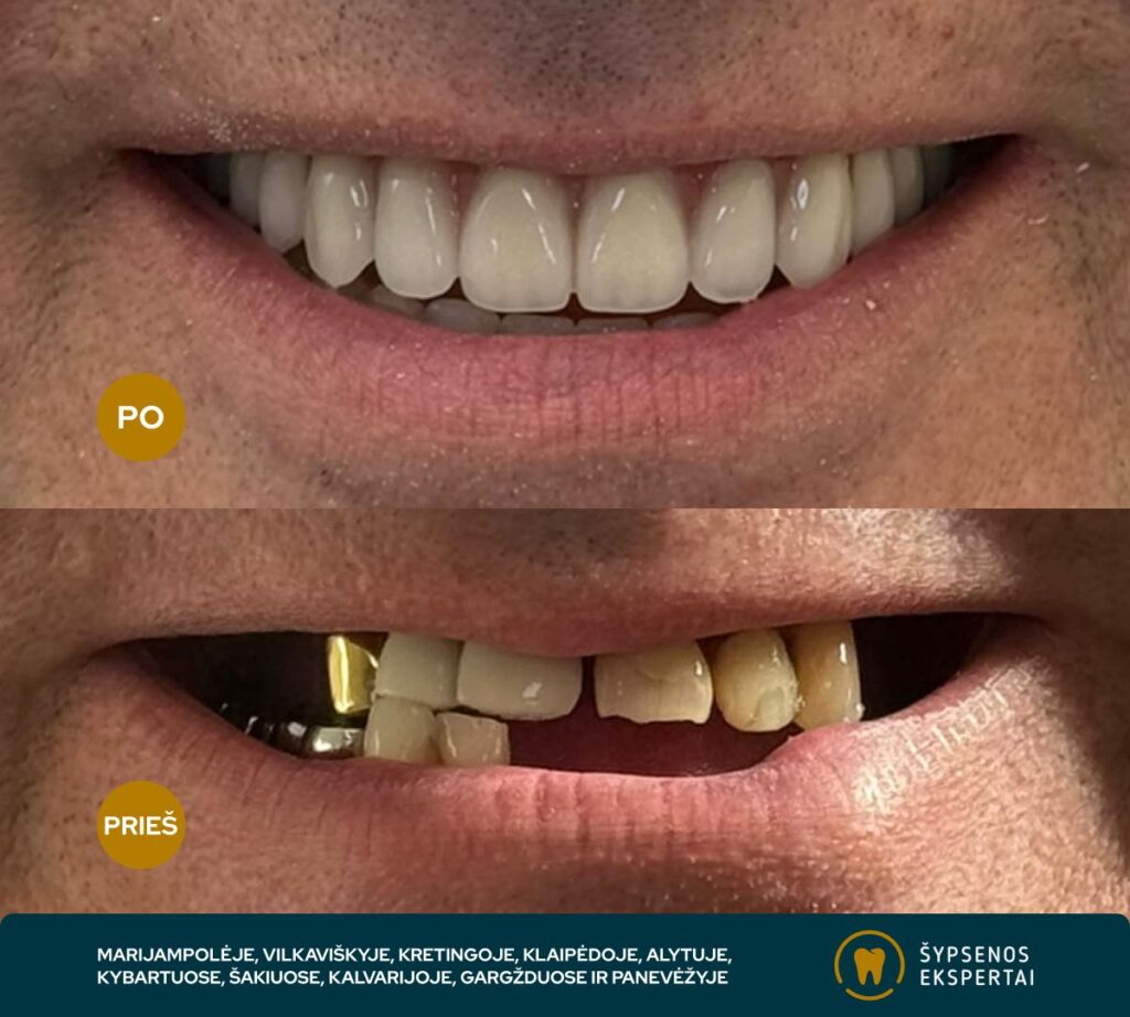 all on 4_atliktu darbu galerija