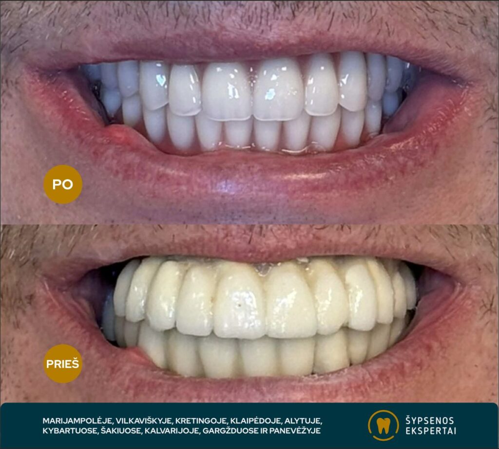 all on 4_atliktu darbu galerija