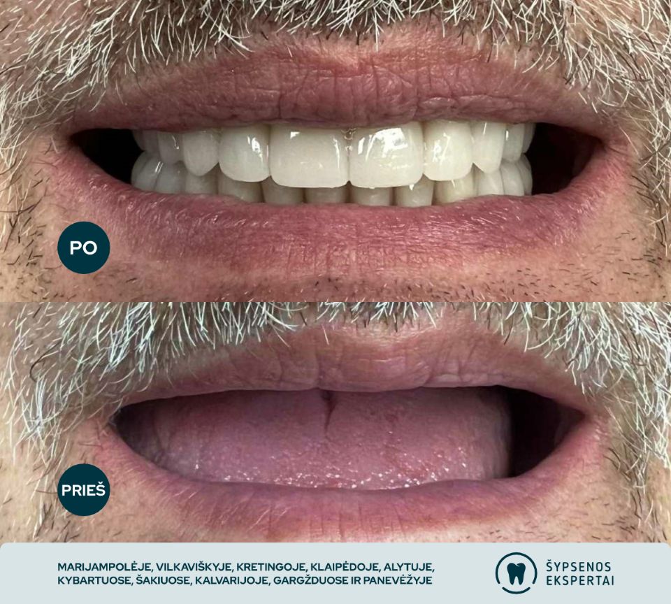 all on 4_atliktu darbu galerija