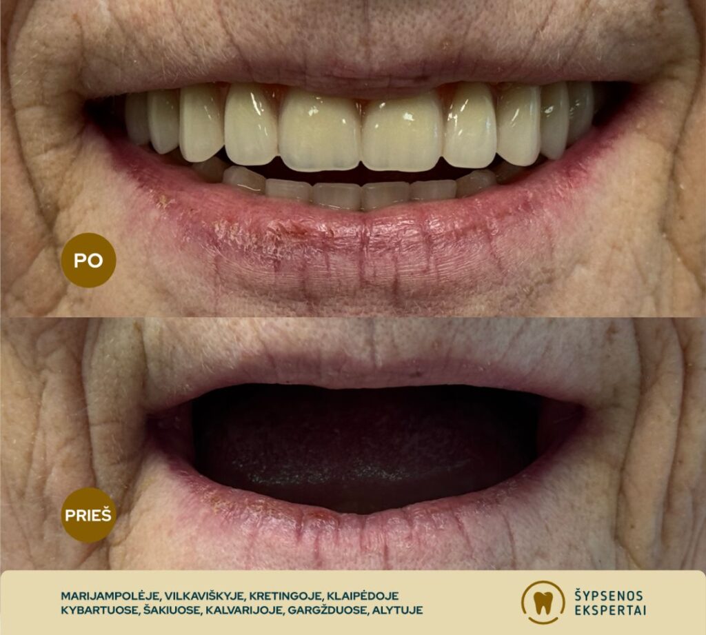 all on 4_atliktu darbu galerija