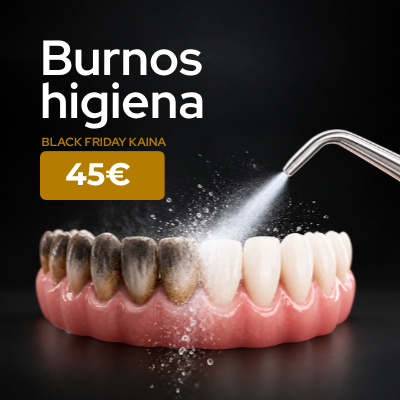 Burnos higiena spec pasiulymas 45 eur