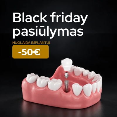 spec pasiulymas dantu implantui